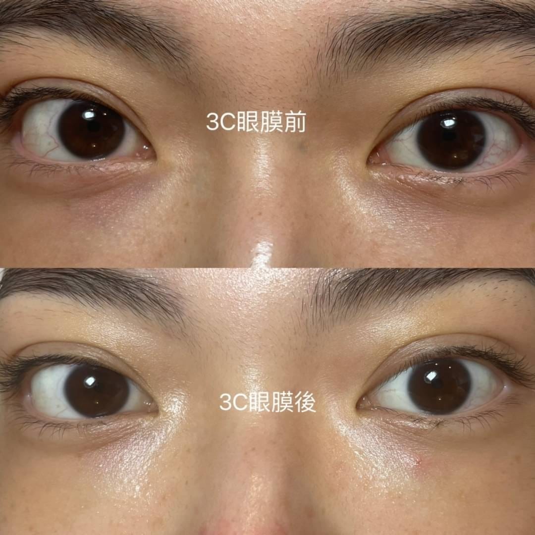 【新北三重做臉】寶麗萊美容SPA│問題肌膚調理專家│專業無痛