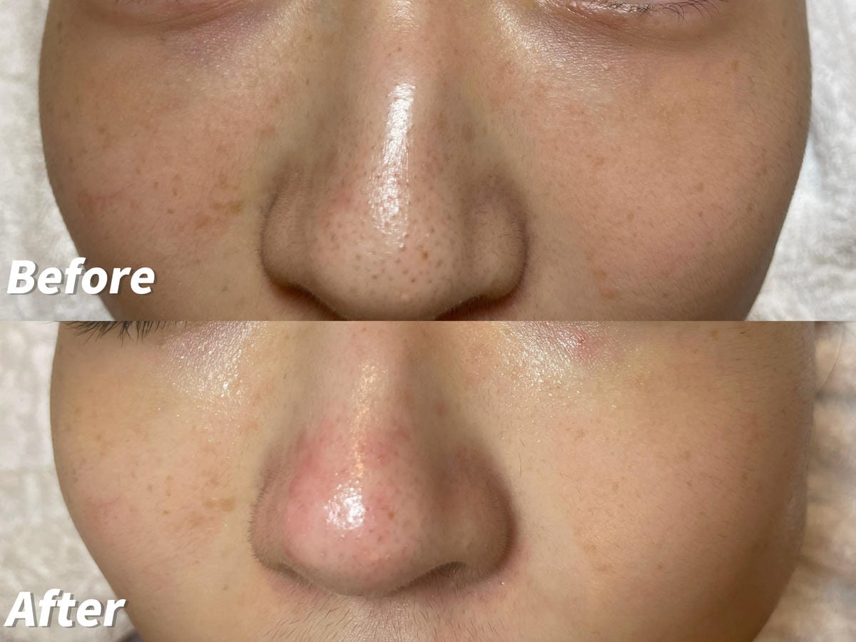 【新北三重做臉】寶麗萊美容SPA│問題肌膚調理專家│專業無痛