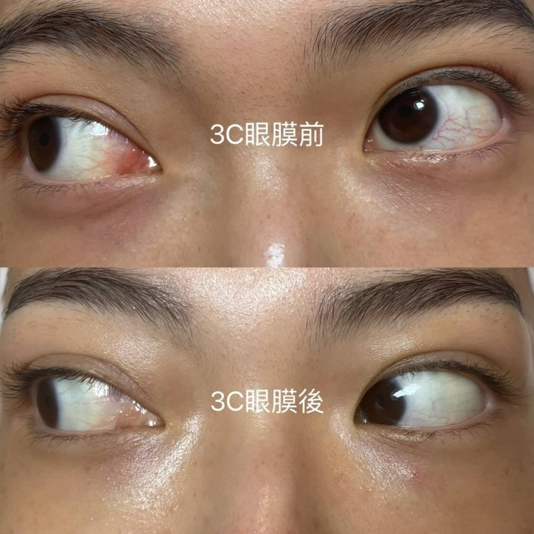 【新北三重做臉】寶麗萊美容SPA│問題肌膚調理專家│專業無痛