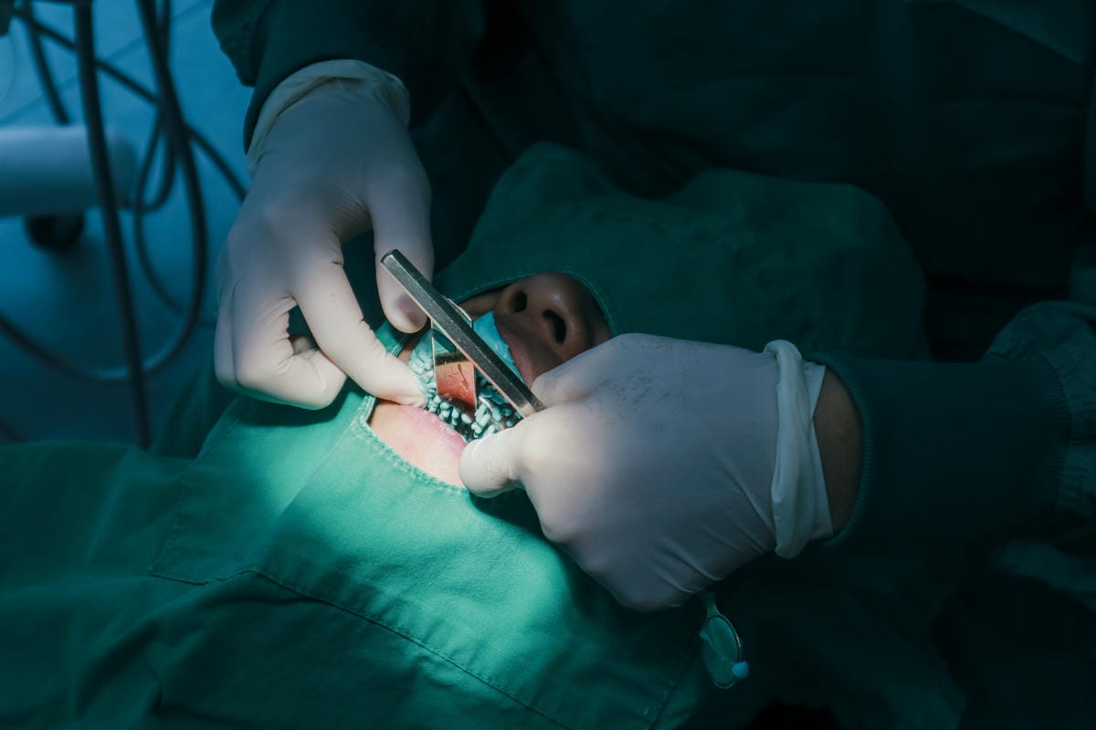 【新竹牙醫推薦】你知道如何有效預防蛀牙嗎? ｜洗牙、個人 氟