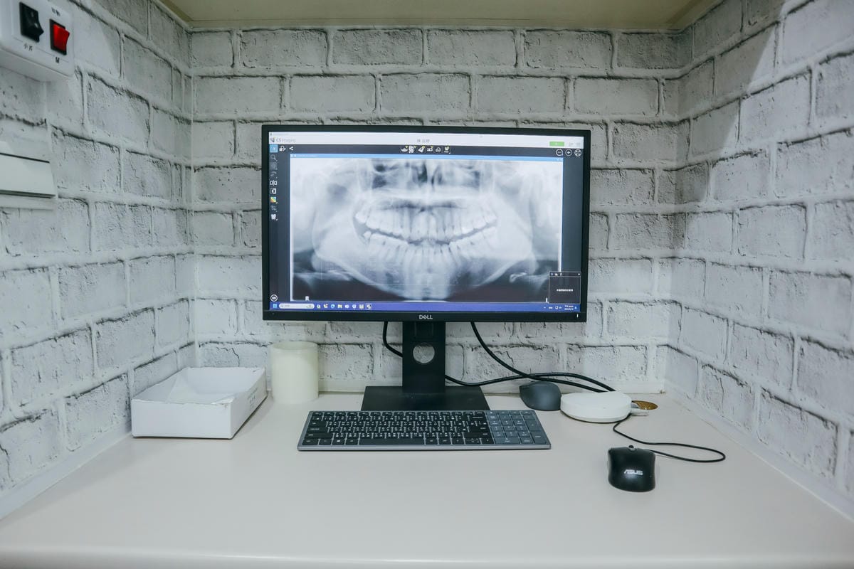 【新竹牙醫推薦】你知道如何有效預防蛀牙嗎? ｜洗牙、個人 氟