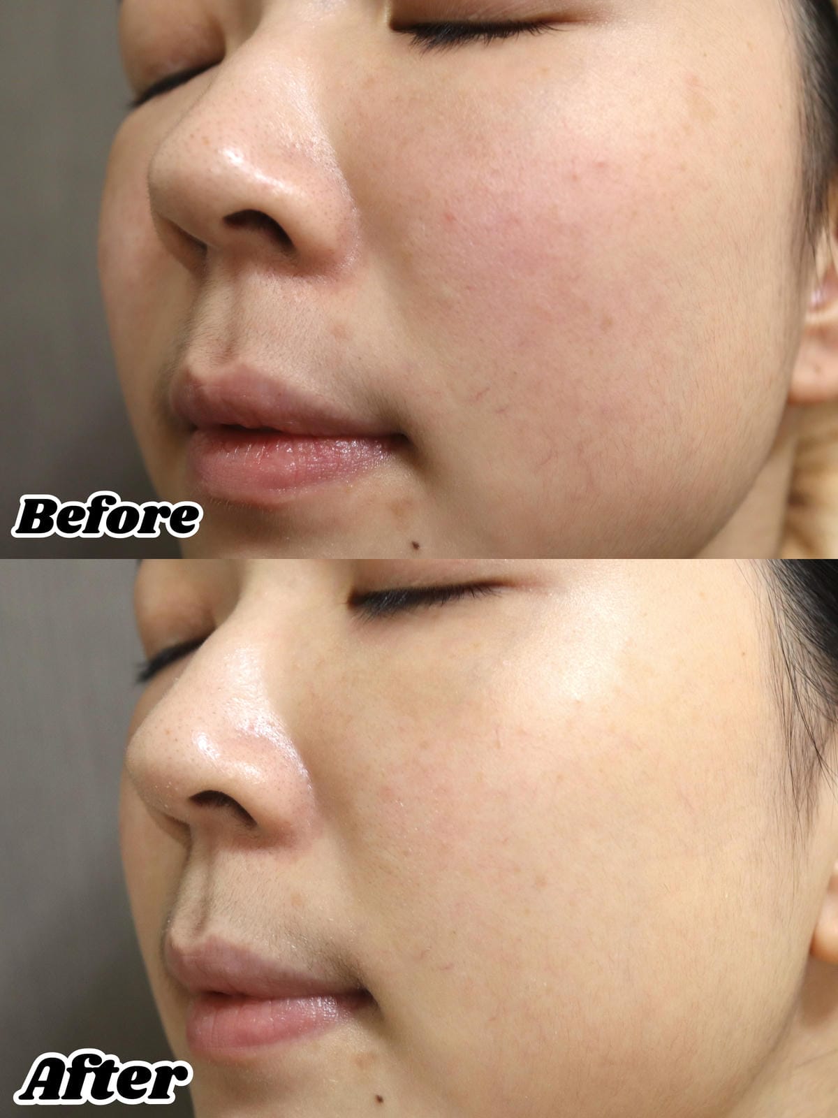 【好物分享】MIRAE 未來美 早C晚A組合│超級A醇 抗老