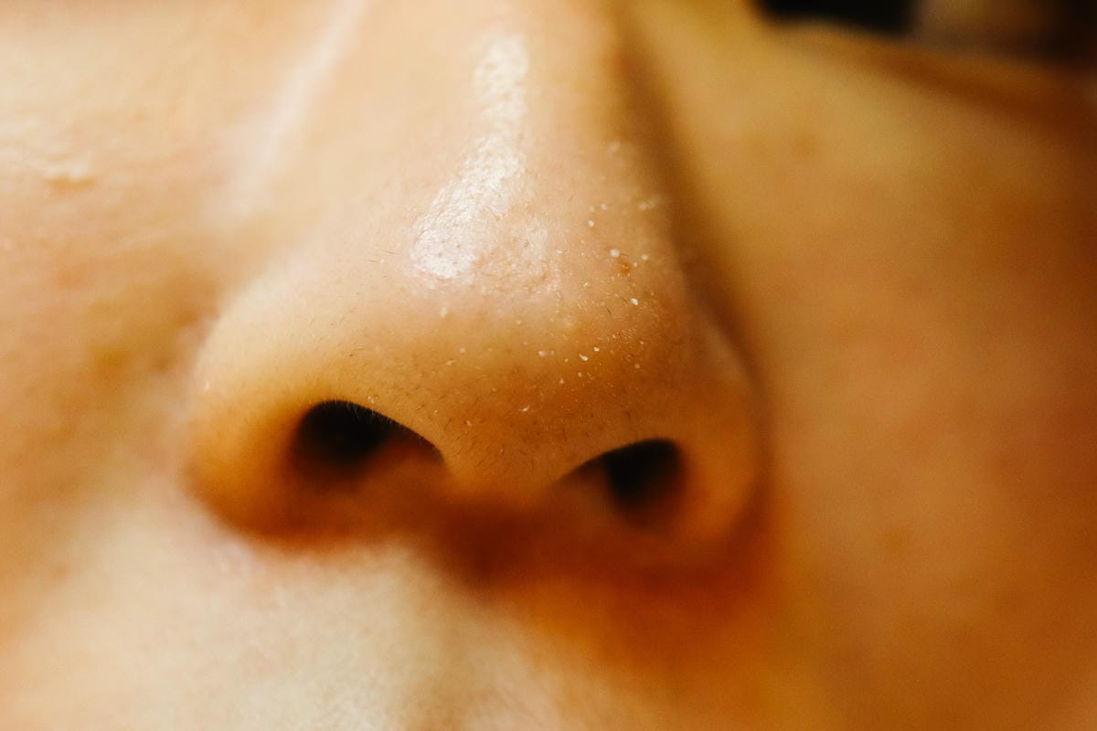 【新北板橋做臉】NINIS STUDIO 美肌館│問題肌膚改