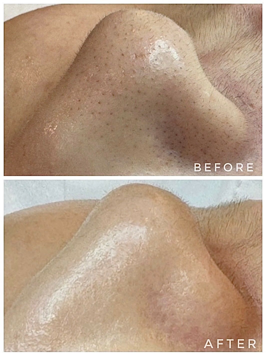 【新北板橋做臉】NINIS STUDIO 美肌館│問題肌膚改