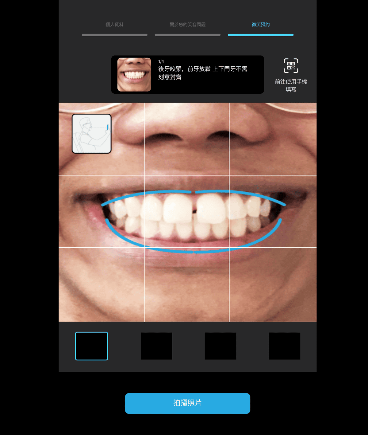 【口腔保健】Zenyum綻雅│Zenyum 綻雅隱形牙套│讓