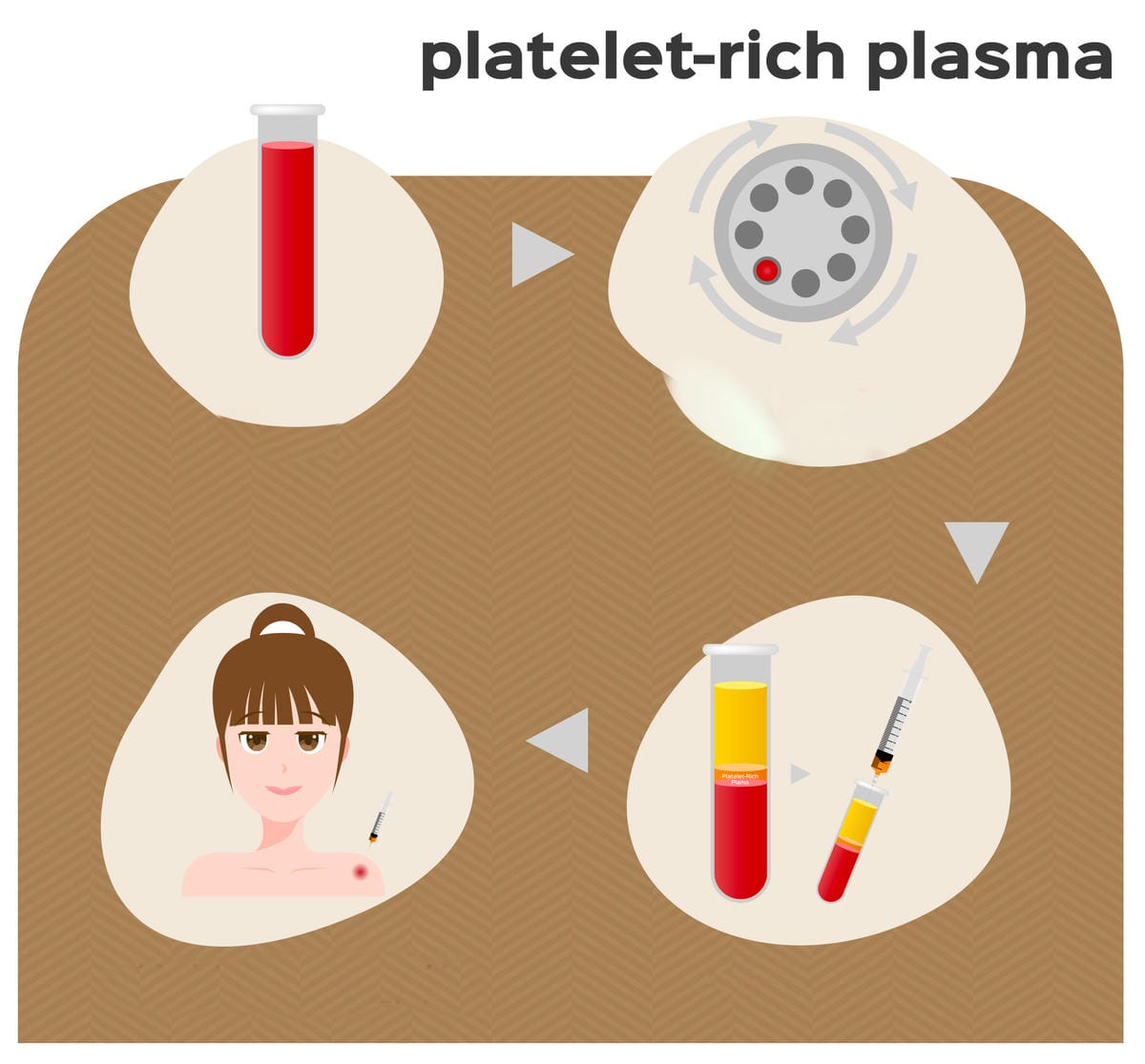 【PRP生長因子蘊髮】植診所 Le Bourgeon│帶爸爸 【PRP生長因子蘊髮】植診所 Le Bourgeon│帶爸爸