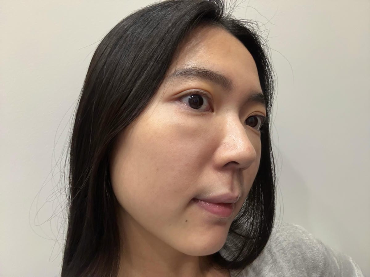 【韓國醫美】韓國id醫院｜95折預約優惠連結｜第五代美國鳳凰